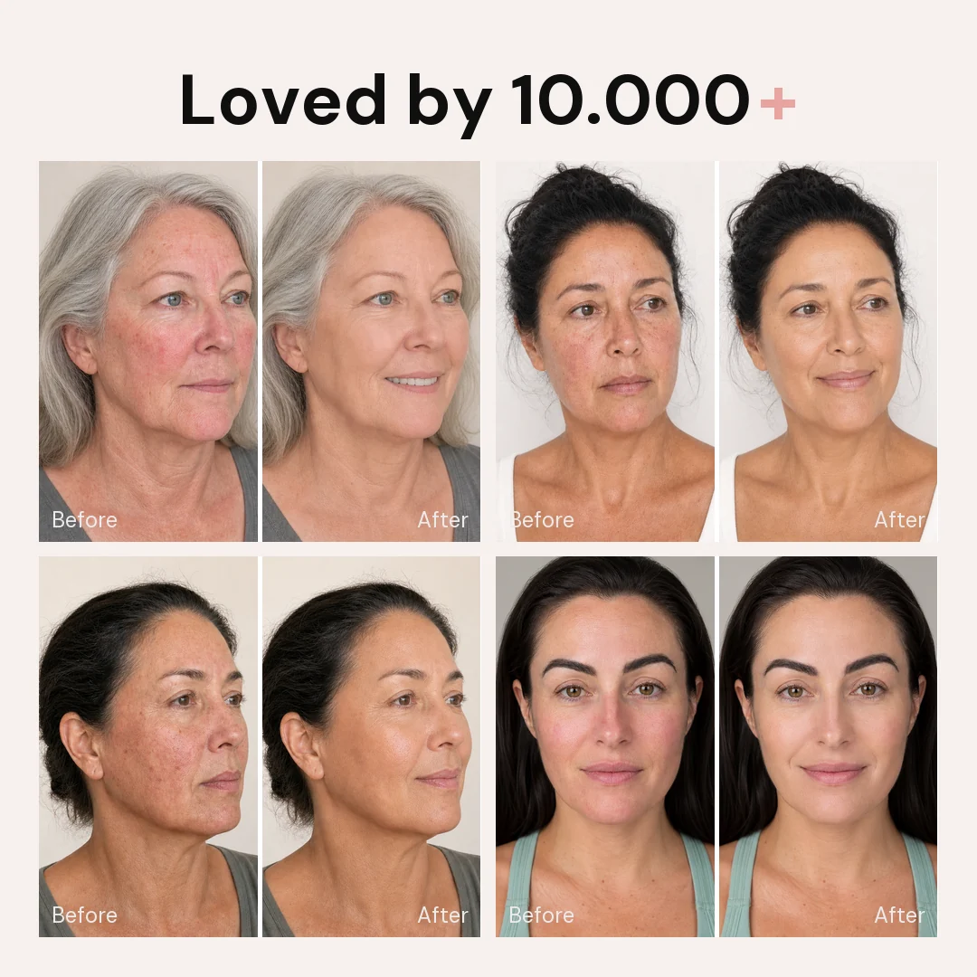 Korean Blemish Balm